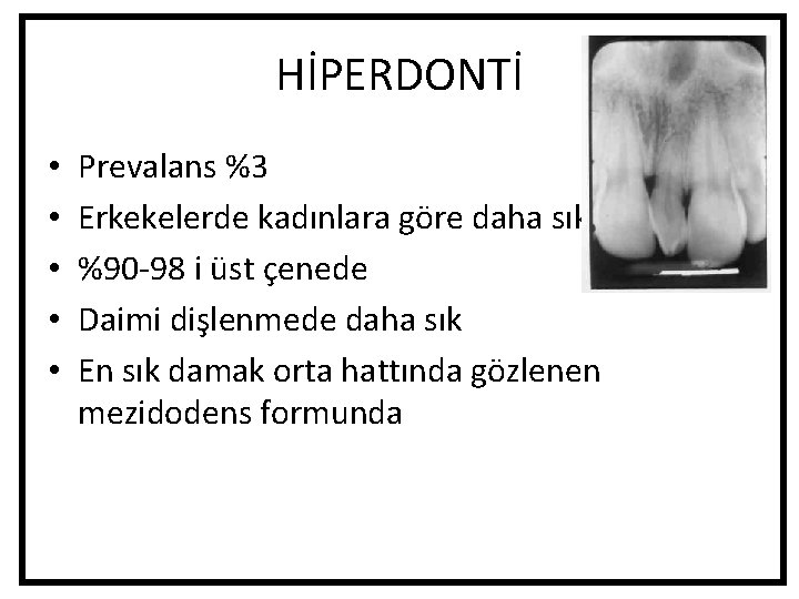 HİPERDONTİ • • • Prevalans %3 Erkekelerde kadınlara göre daha sık %90 -98 i HİPERDONTİ • • • Prevalans %3 Erkekelerde kadınlara göre daha sık %90 -98 i