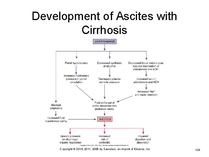 Development of Ascites with Cirrhosis • Copyright © 2014, 2011, 2006 by Saunders, an