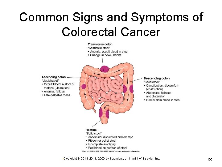 Common Signs and Symptoms of Colorectal Cancer • Copyright © 2014, 2011, 2006 by