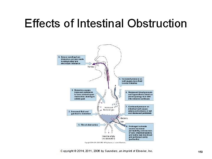 Effects of Intestinal Obstruction • Copyright © 2014, 2011, 2006 by Saunders, an imprint