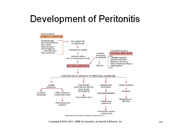 Development of Peritonitis • Copyright © 2014, 2011, 2006 by Saunders, an imprint of