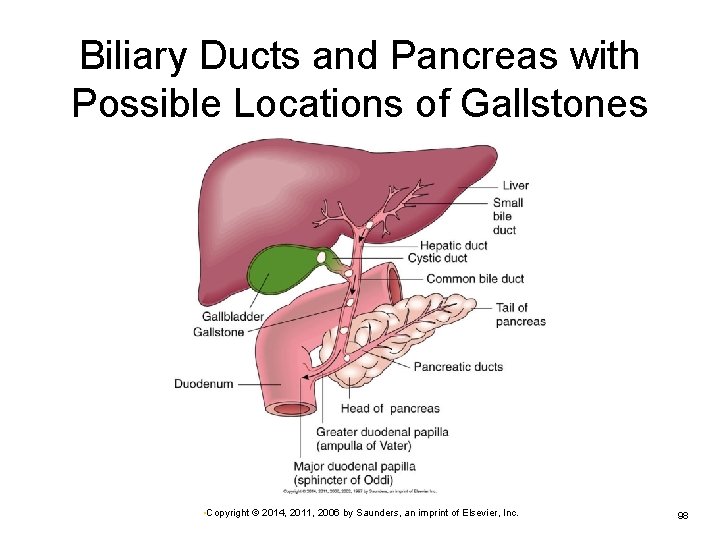 Biliary Ducts and Pancreas with Possible Locations of Gallstones • Copyright © 2014, 2011,