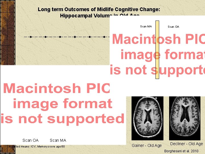 Long term Outcomes of Midlife Cognitive Change: Hippocampal Volume in Old Age Scan MA