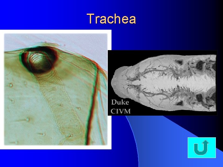 Trachea 