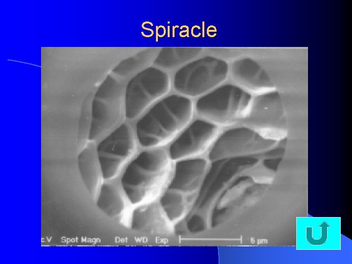 Spiracle 