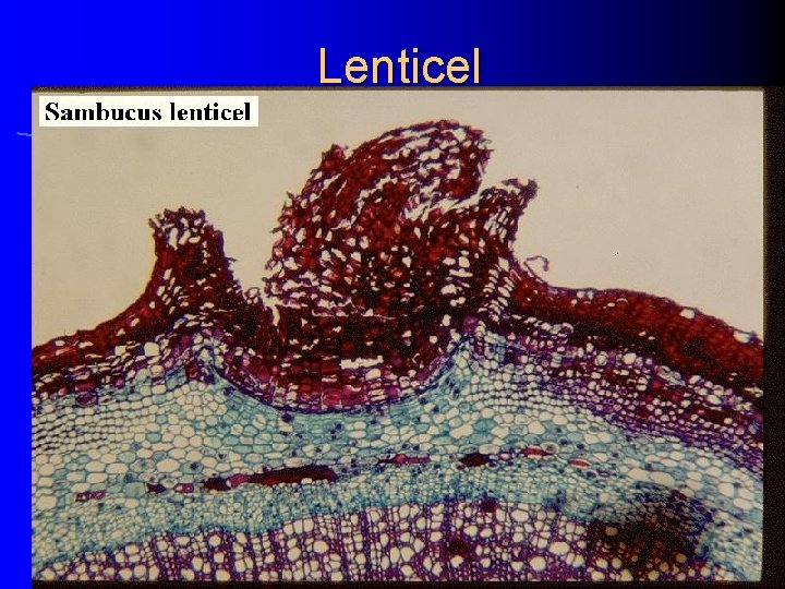 Lenticel 