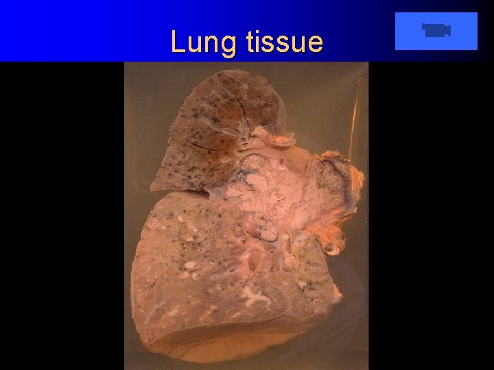 Lung tissue 