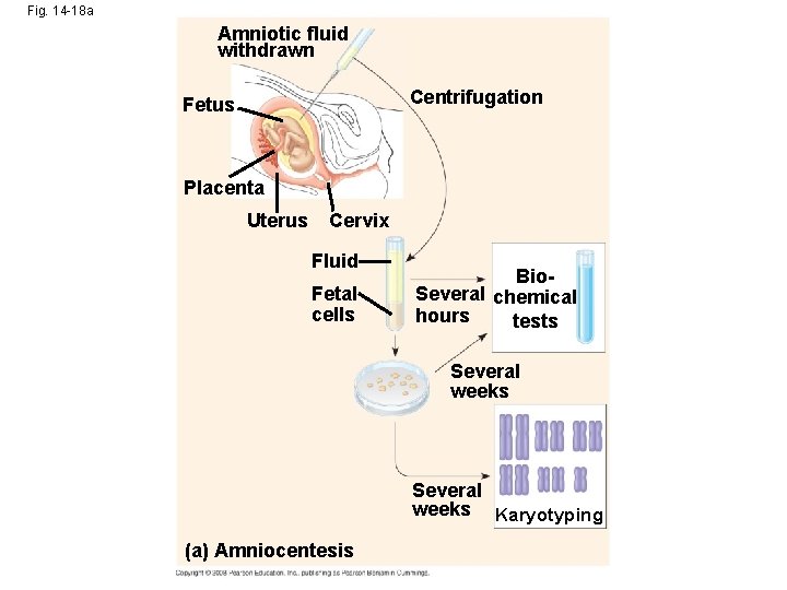 Fig. 14 -18 a Amniotic fluid withdrawn Centrifugation Fetus Placenta Uterus Cervix Fluid Fetal Fig. 14 -18 a Amniotic fluid withdrawn Centrifugation Fetus Placenta Uterus Cervix Fluid Fetal
