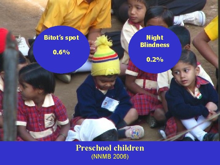 Bitot’s spot Night Blindness 0. 6% 0. 2% Preschool children (NNMB 2006) 