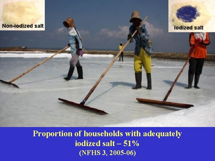 Non-iodized salt Iodized salt Proportion of households with adequately iodized salt – 51% (NFHS