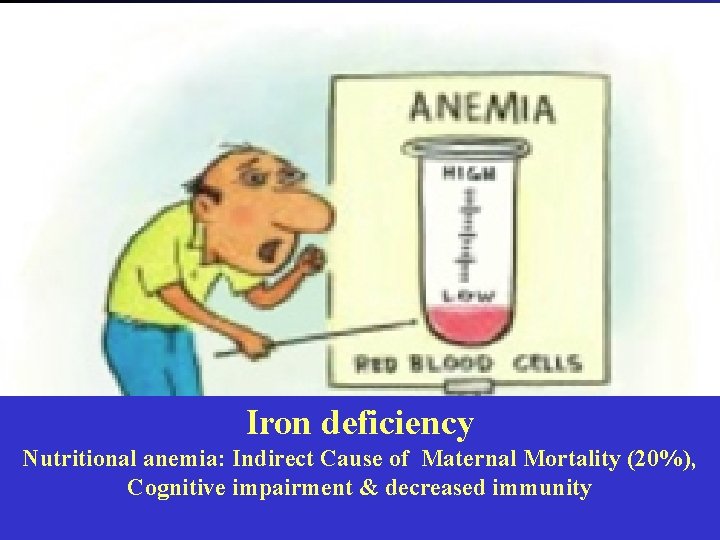 Iron deficiency Nutritional anemia: Indirect Cause of Maternal Mortality (20%), Cognitive impairment & decreased