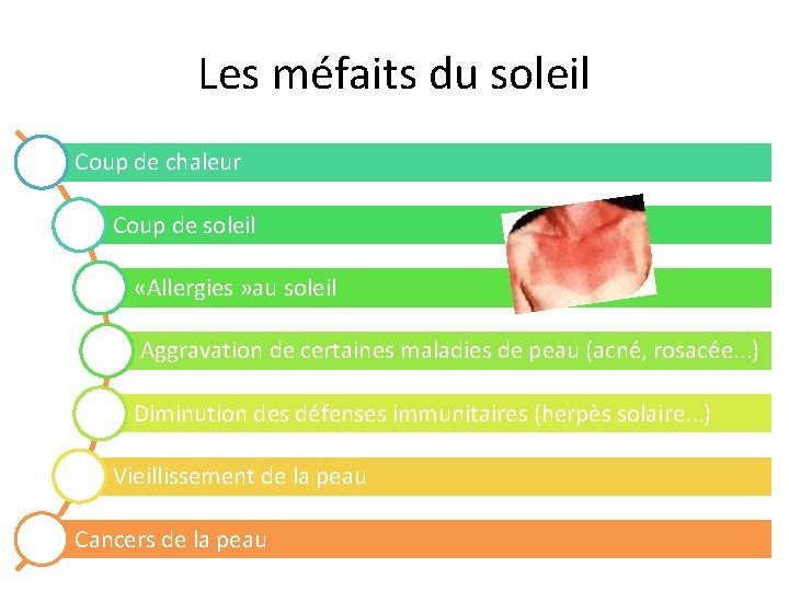 Les méfaits du soleil Coup de chaleur Coup de soleil «Allergies » au soleil Les méfaits du soleil Coup de chaleur Coup de soleil «Allergies » au soleil