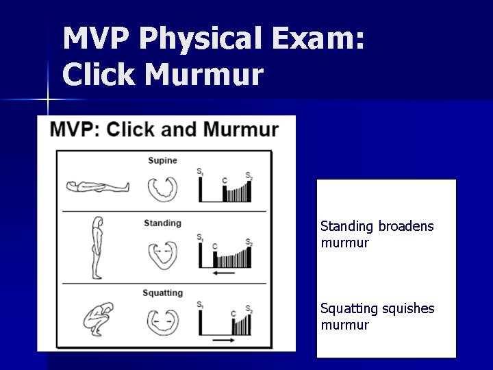 MVP Physical Exam: Click Murmur Standing broadens murmur Squatting squishes murmur 