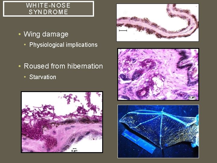 WHI TE-NOSE SYNDROME • Wing damage • Physiological implications • Roused from hibernation •