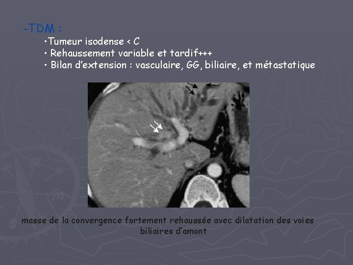 -TDM : • Tumeur isodense < C • Rehaussement variable et tardif+++ • Bilan