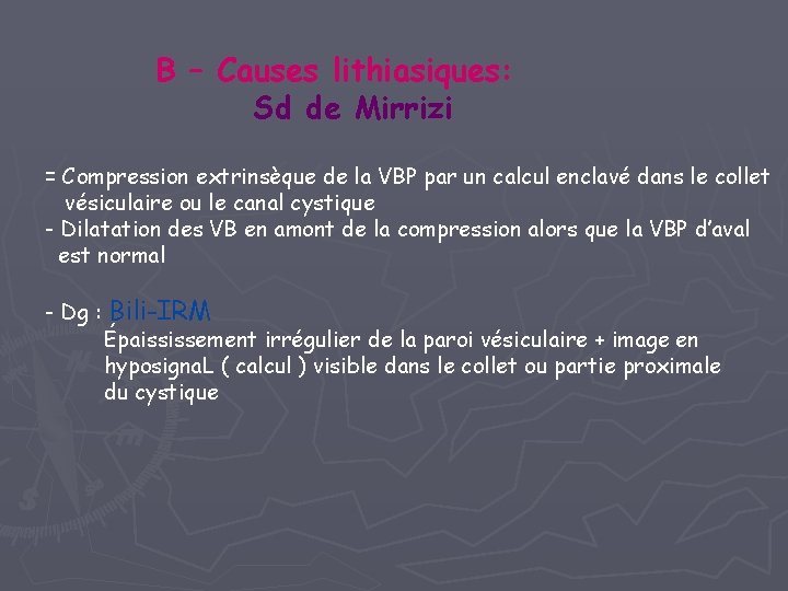 B – Causes lithiasiques: Sd de Mirrizi = Compression extrinsèque de la VBP par