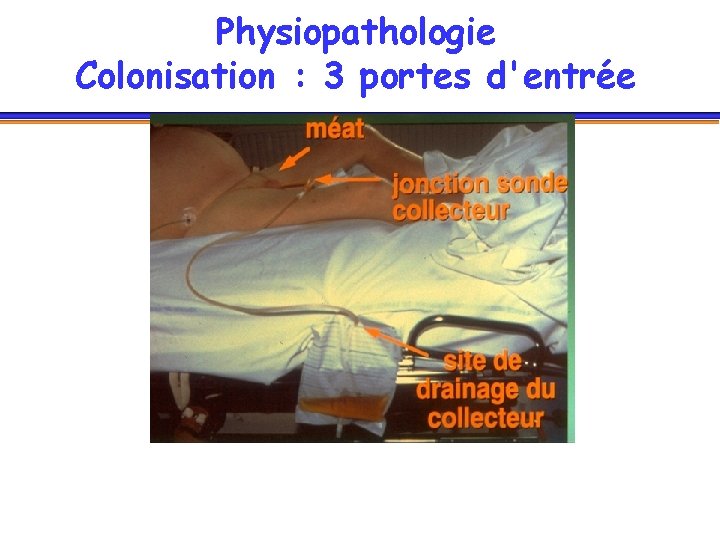 Physiopathologie Colonisation : 3 portes d'entrée 