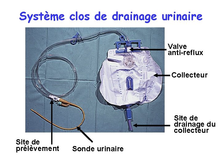Système clos de drainage urinaire Valve anti-reflux Collecteur Site de drainage du collecteur Site