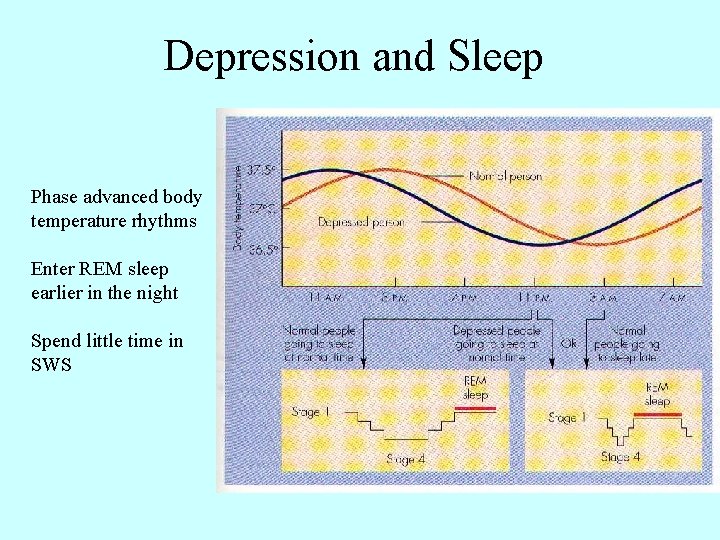 Depression and Sleep Phase advanced body temperature rhythms Enter REM sleep earlier in the