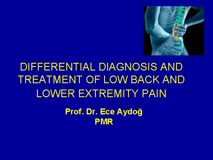 DIFFERENTIAL DIAGNOSIS AND TREATMENT OF LOW BACK AND LOWER EXTREMITY PAIN Prof. Dr. Ece