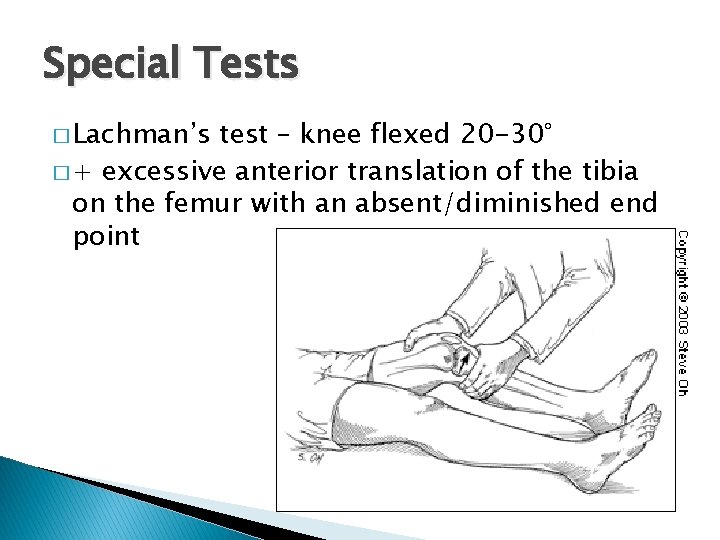 Special Tests � Lachman’s test – knee flexed 20 -30° � + excessive anterior