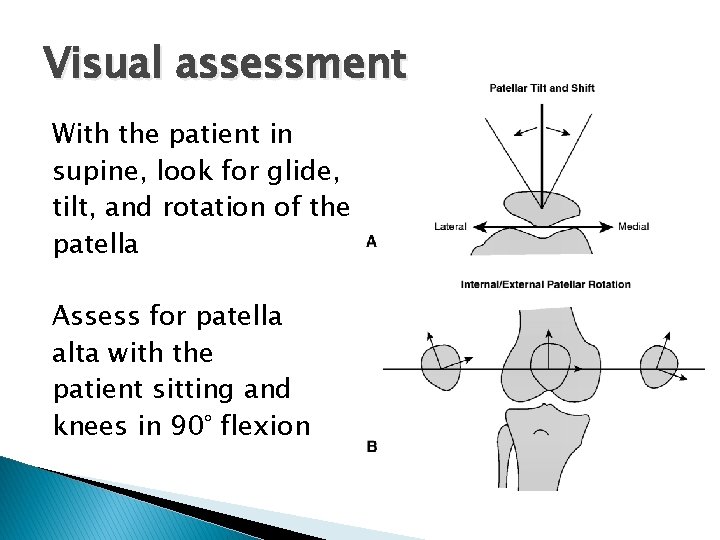 Visual assessment With the patient in supine, look for glide, tilt, and rotation of