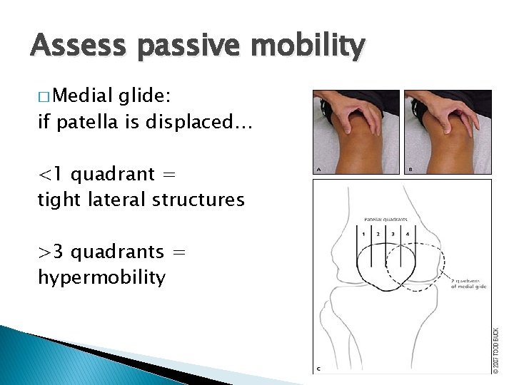 Assess passive mobility � Medial glide: if patella is displaced… <1 quadrant = tight