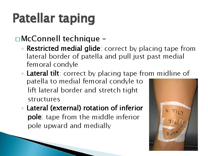 Patellar taping � Mc. Connell technique – ◦ Restricted medial glide: correct by placing
