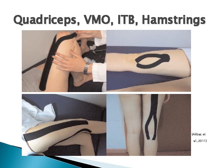 Quadriceps, VMO, ITB, Hamstrings (Akbas et al. , 2011) 