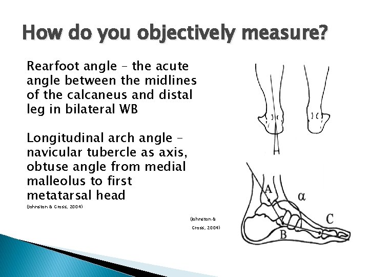 How do you objectively measure? Rearfoot angle – the acute angle between the midlines