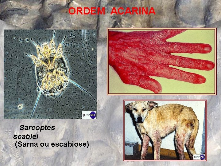  ORDEM ACARINA Sarcoptes scabiei (Sarna ou escabiose) 