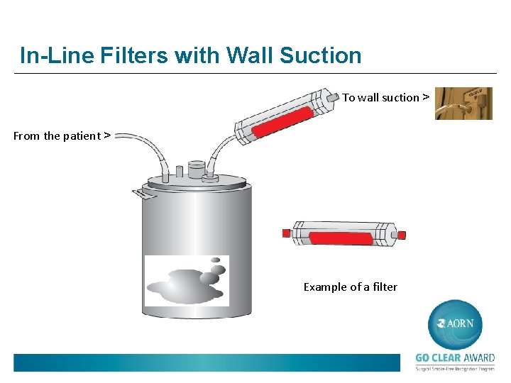 In-Line Filters with Wall Suction To wall suction > From the patient > Example