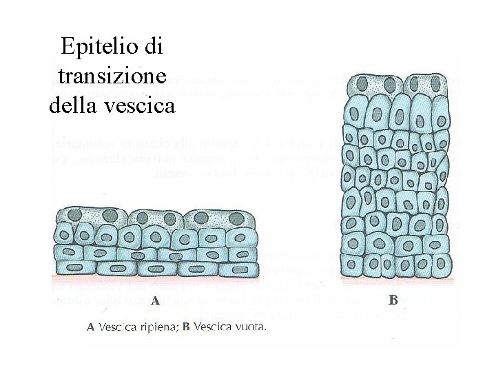Epitelio di transizione della vescica Epitelio di transizione della vescica