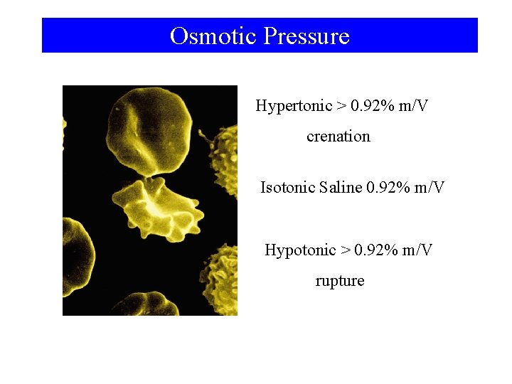 Osmotic Pressure Hypertonic > 0. 92% m/V crenation Isotonic Saline 0. 92% m/V Hypotonic