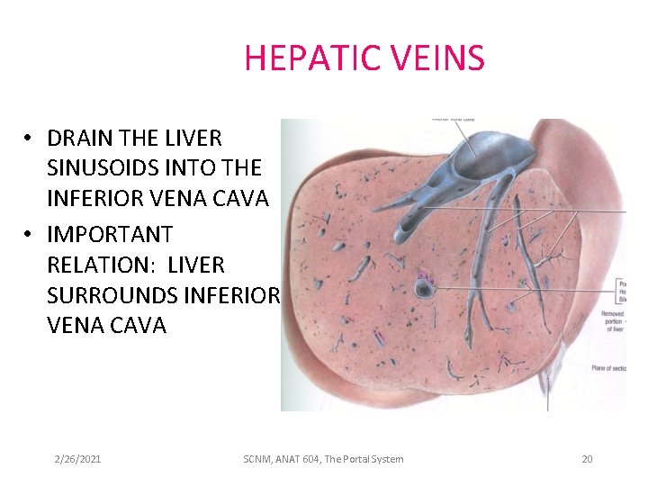 HEPATIC VEINS • DRAIN THE LIVER SINUSOIDS INTO THE INFERIOR VENA CAVA • IMPORTANT