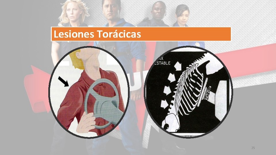 Lesiones Torácicas 25 
