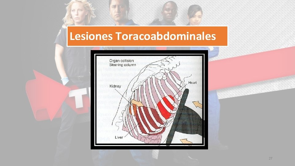 Lesiones Toracoabdominales 27 