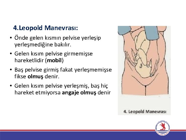 4. Leopold Manevrası: • Önde gelen kısmın pelvise yerleşip yerleşmediğine bakılır. • Gelen kısım