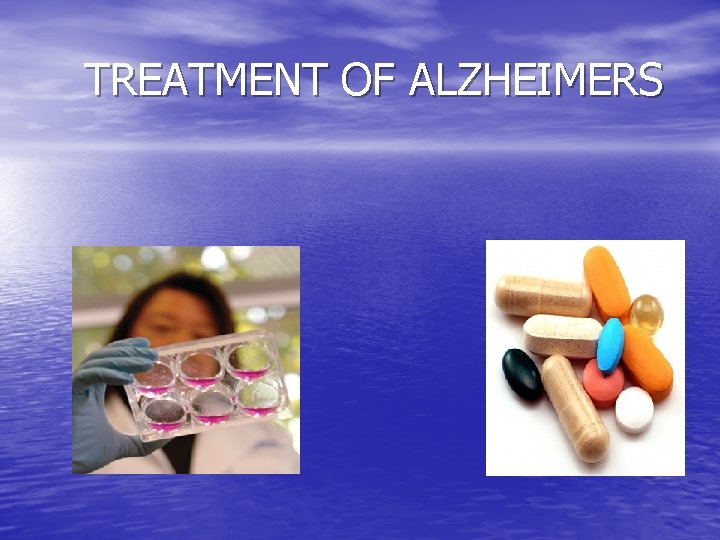  TREATMENT OF ALZHEIMERS 