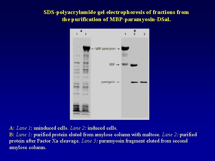 SDS-polyacrylamide gel electrophoresis of fractions from the purification of MBP-paramyosin-DSal. A: Lane 1: uninduced