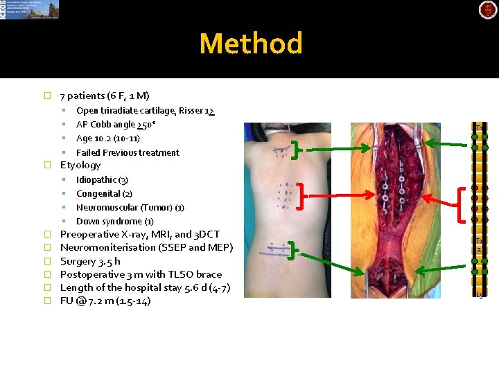 Method � 7 patients (6 F, 1 M) � T 1 Etyology � �