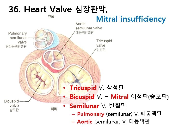 36. Heart Valve 심장판막, Mitral insufficiency • Tricuspid V. 삼첨판 • Bicuspid V. =