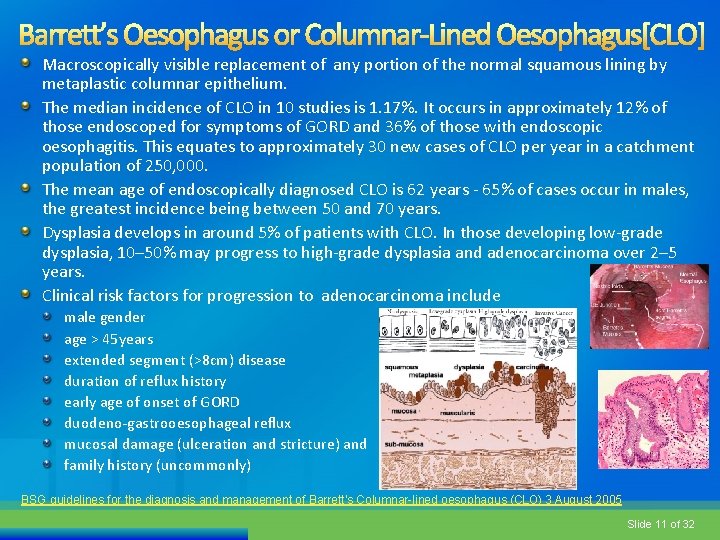 Macroscopically visible replacement of any portion of the normal squamous lining by metaplastic columnar