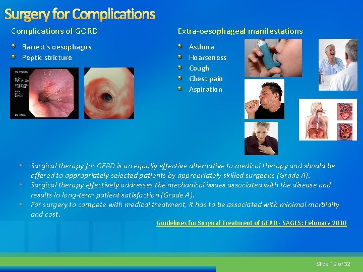 Complications of GORD Barrett's oesophagus Peptic stricture • • • Extra-oesophageal manifestations Asthma Hoarseness