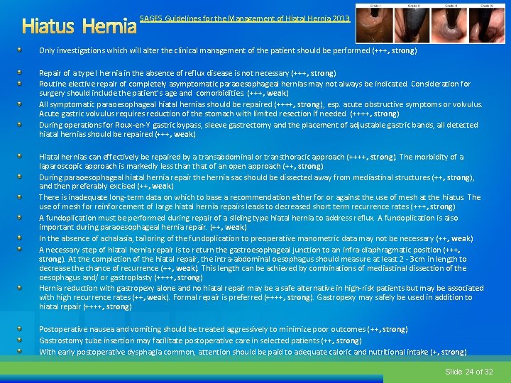 SAGES Guidelines for the Management of Hiatal Hernia 2013 Only investigations which will alter