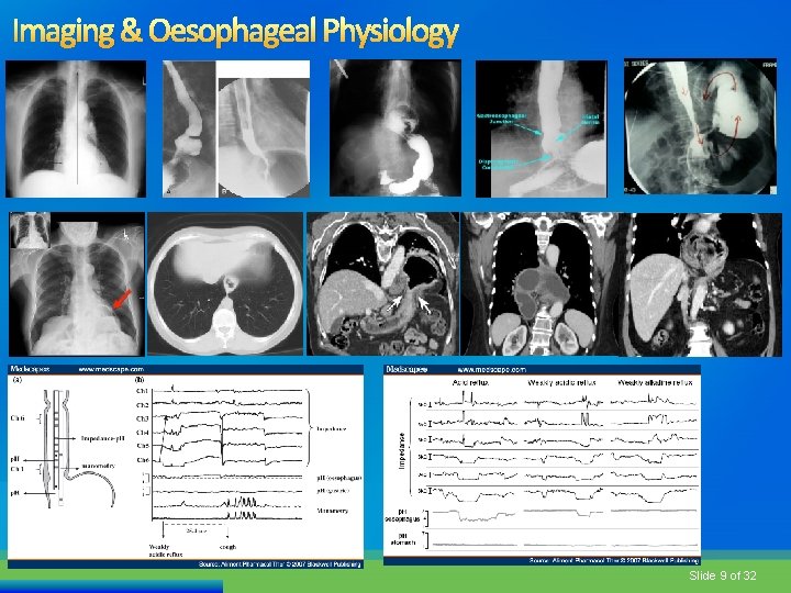 Imaging & Oesophageal Physiology Slide 9 of 32 