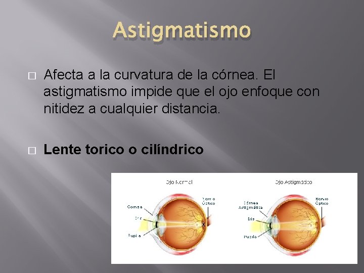 Astigmatismo � Afecta a la curvatura de la córnea. El astigmatismo impide que el Astigmatismo � Afecta a la curvatura de la córnea. El astigmatismo impide que el