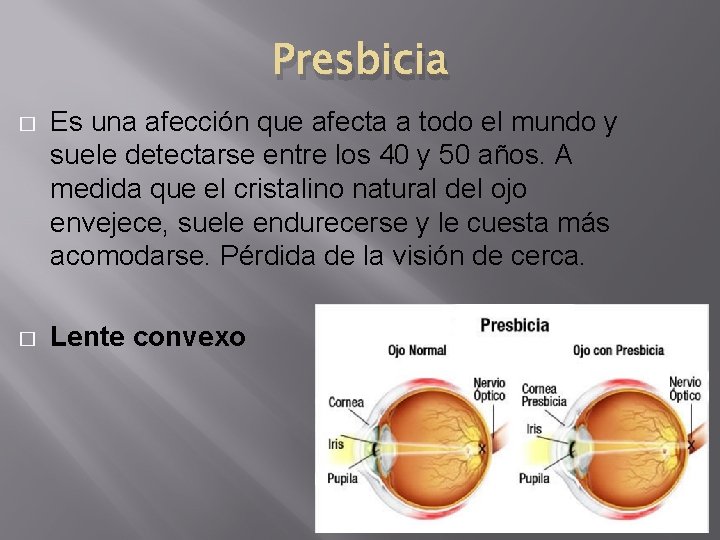 Presbicia � Es una afección que afecta a todo el mundo y suele detectarse Presbicia � Es una afección que afecta a todo el mundo y suele detectarse