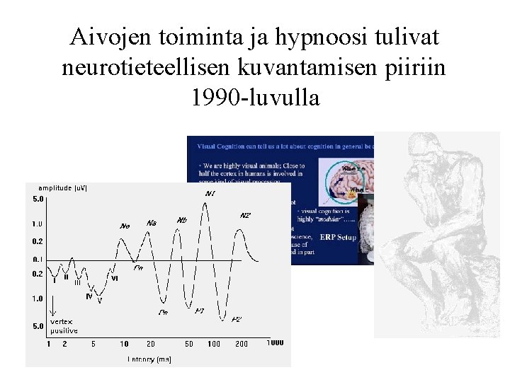 Aivojen toiminta ja hypnoosi tulivat neurotieteellisen kuvantamisen piiriin 1990 -luvulla 