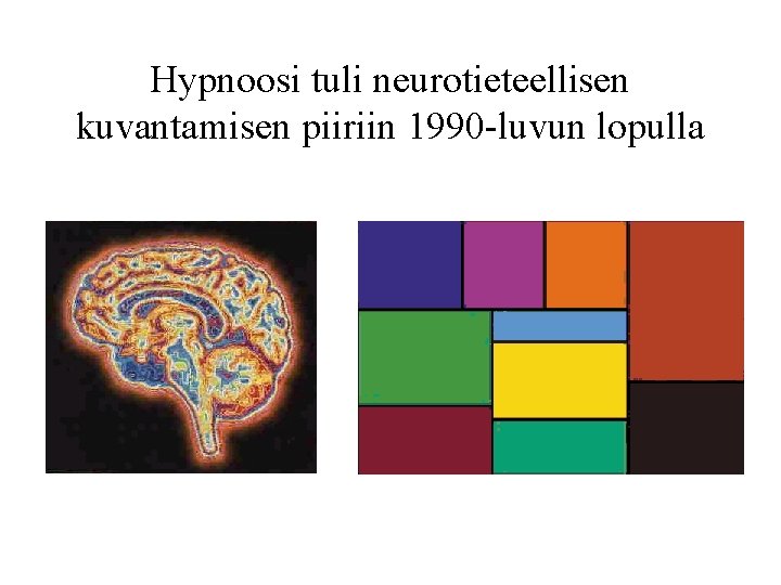 Hypnoosi tuli neurotieteellisen kuvantamisen piiriin 1990 -luvun lopulla 